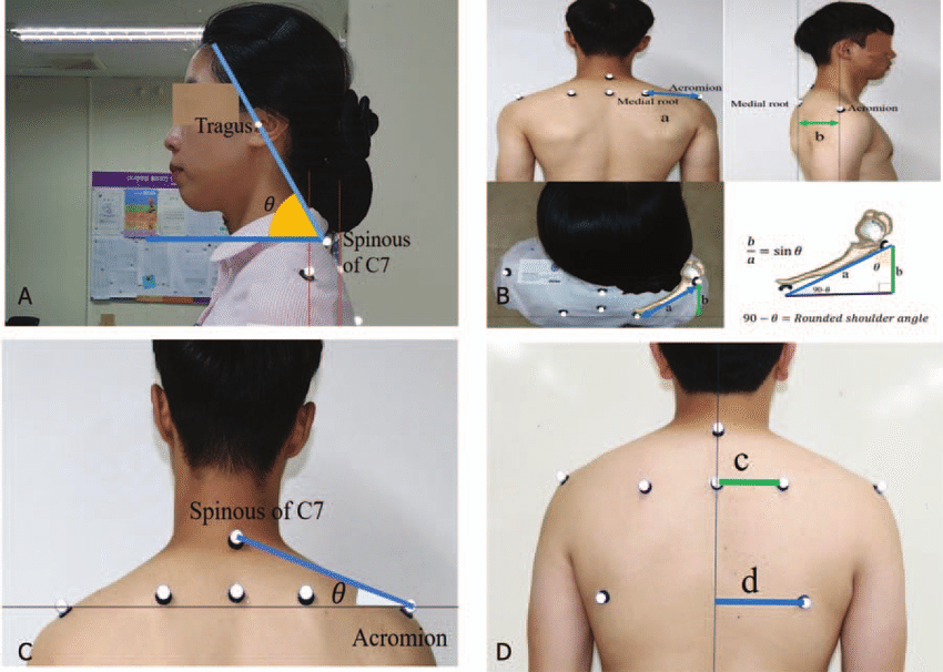 Head and Neck Posture Analysis Images